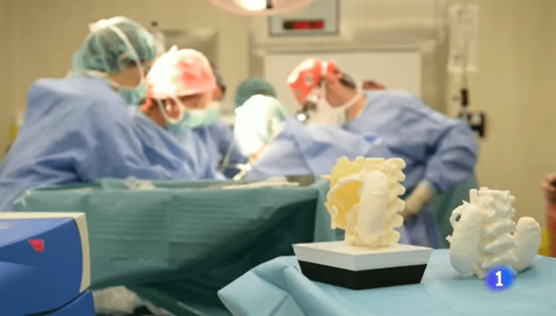 Impresión 3D aplicada a la extirpación de un tumor Impresión 3D aplicada a la extirpación de un tumor
