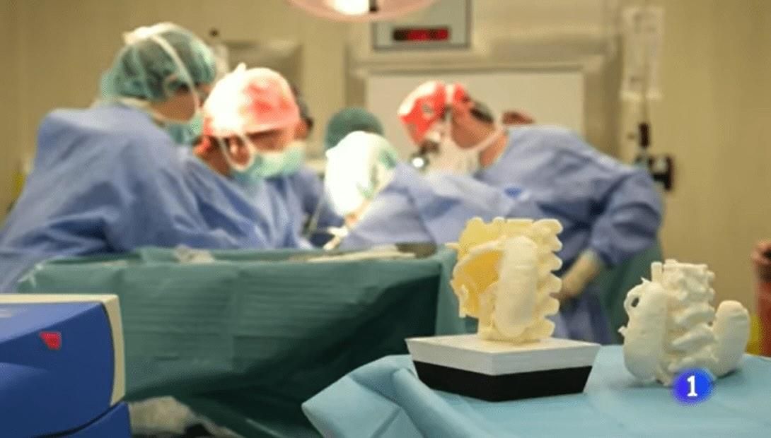 Impresión 3D aplicada a la extirpación de un tumor