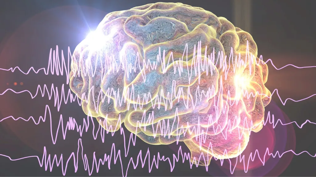 brain epilepsy