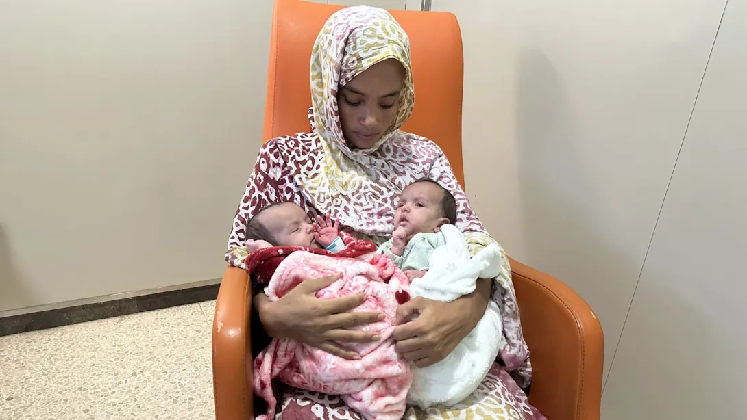 Conjoined twins separated successfully at the SJD Barcelona Children's Hospital Conjoined twins separated at the SJD Barcelona Children's Hospital