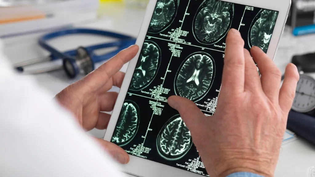 estudio pruebas neuroimagen