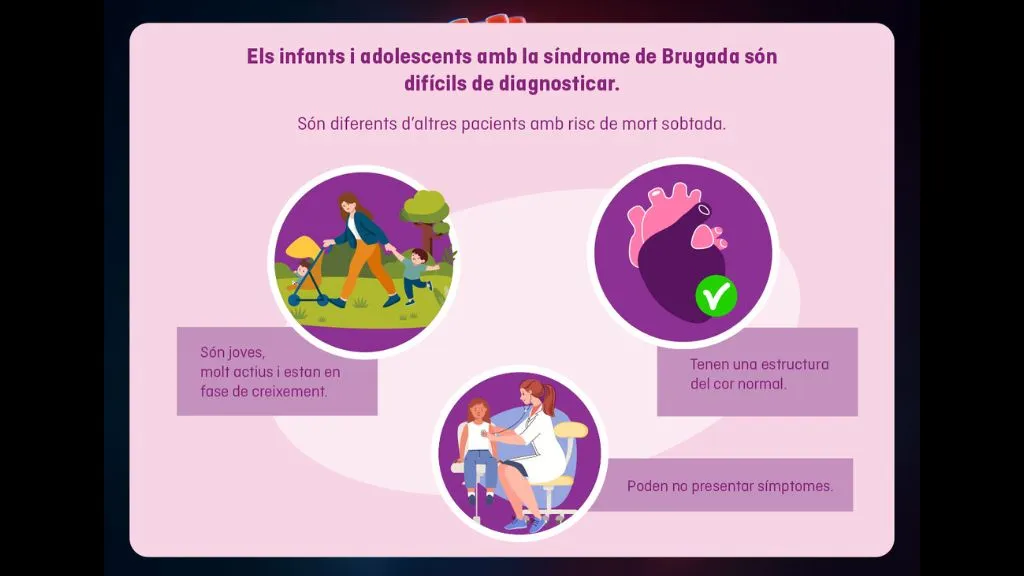 La síndrome de Brugada en infants