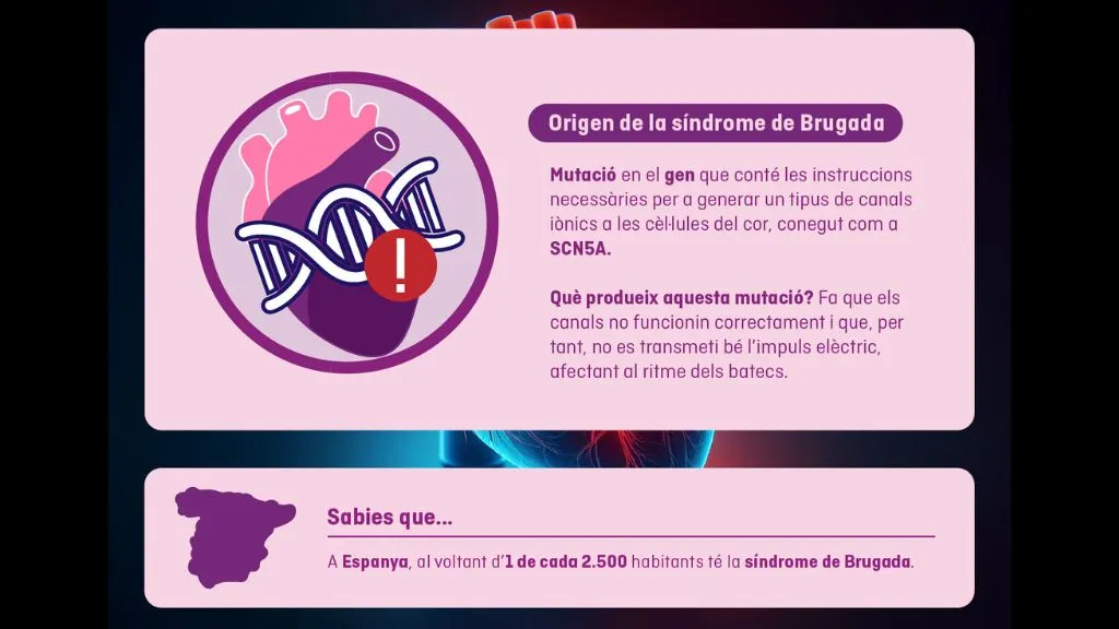 Origen de la síndrome de Brugada