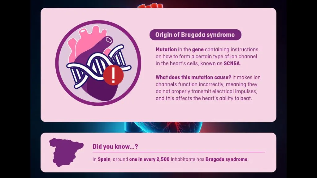 Brugada syndrome