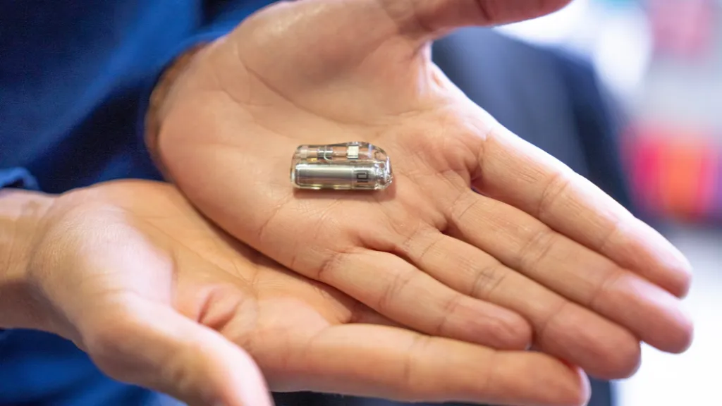 marcapasos bebe abbott sant joan deu