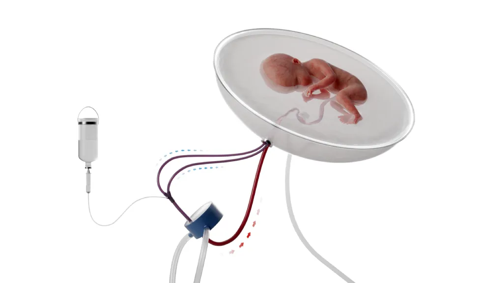Grafisme placenta artificial Grafisme placenta artificial Hospital Sant Joan de Déu Barcelona