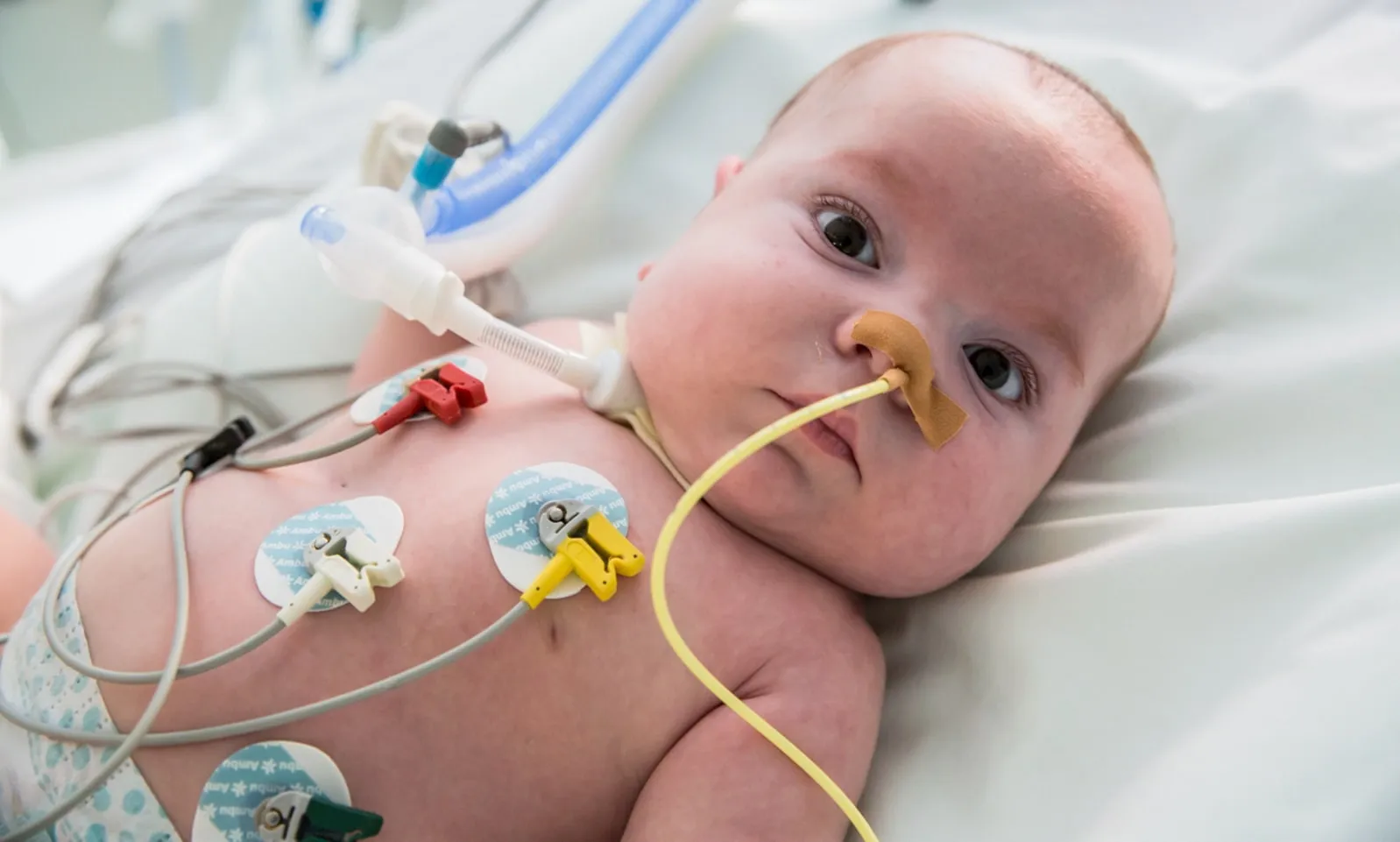Bebé en el Área de Cuidados Intensivos Pediátricos del Hospital Sant Joan de Déu Barcelona Bebé en el Área de Cuidados Intensivos Pediátricos del Hospital Sant Joan de Déu Barcelona