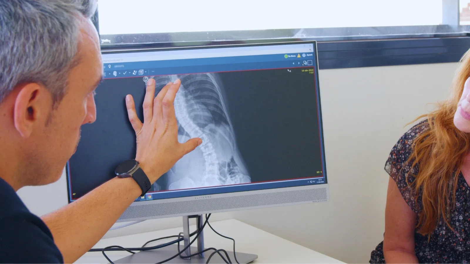 Consultation at the Scoliosis Unit - SJD Barcelona Children's Hospital Consultation at the Scoliosis Unit - SJD Barcelona Children's Hospital