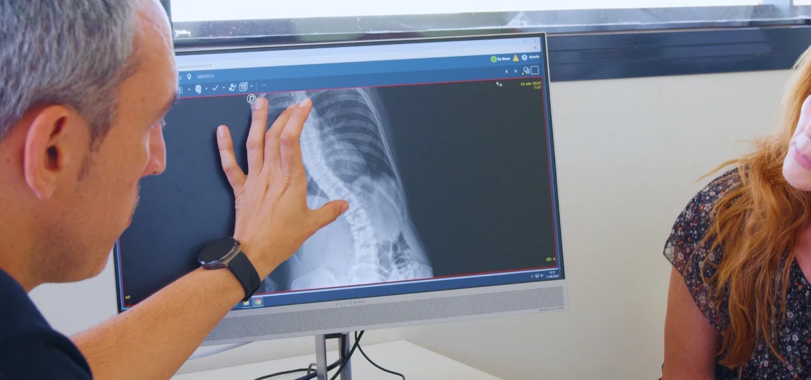 Consulta de la Unidad de Escoliosis - Hospital Sant Joan de Déu Barcelona Consulta de la Unidad de Escoliosis - Hospital Sant Joan de Déu Barcelona