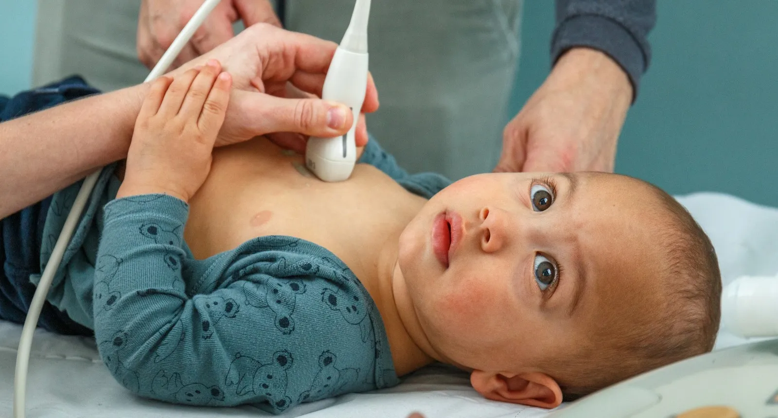 Ecografía cardíaca a un bebé - Hospital Sant Joan de Déu Barcelona