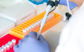 Investigación en neurología pediátrica del Hospital Sant Joan de Déu Barcelona