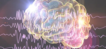 cerebro epilepsia