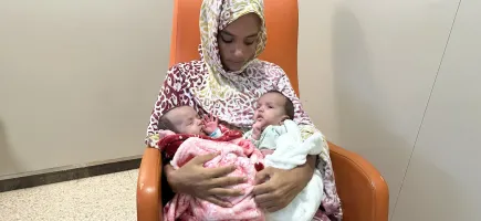Conjoined twins separated successfully at the SJD Barcelona Children's Hospital Conjoined twins separated at the SJD Barcelona Children's Hospital