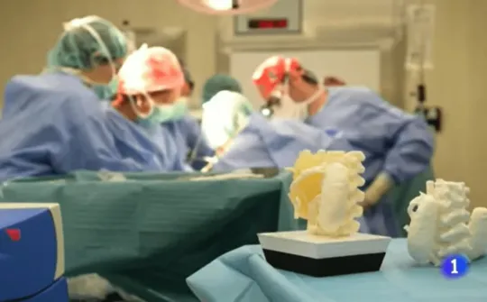 Impresión 3D aplicada a la extirpación de un tumor