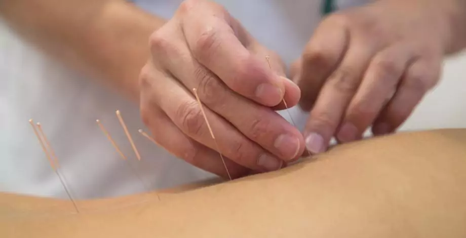 Acupuncture Unit for children and adults at Hospital Sant Joan de Déu Barcelona