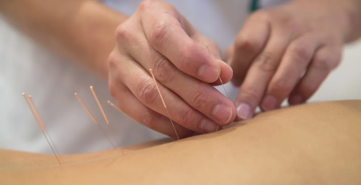 Unidad de Acupuntura para niños y adultos del Hospital Sant Joan de Déu Barcelona