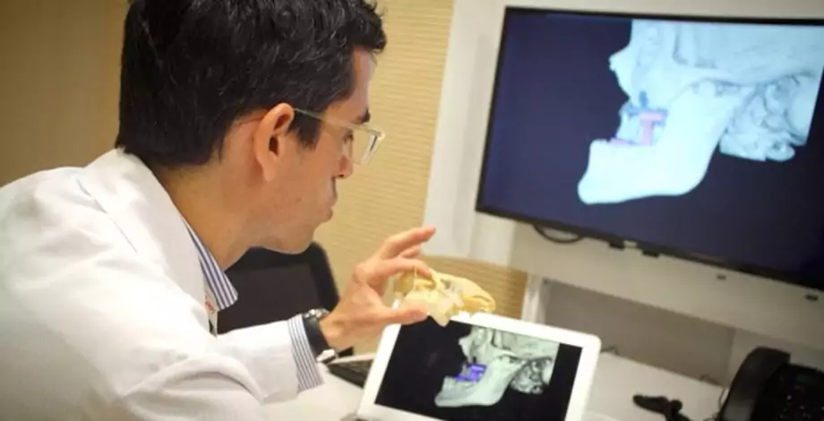 Revisión de una reproducción 3D de Cirugía Maxilofacial infantil en el Hospital Sant Joan de Déu Barcelona
