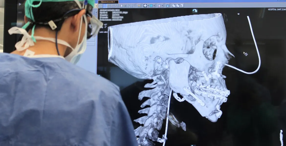 Cirurgià al quiròfan preparant una cirurgia maxil·lofacial planificada amb 3D Cirurgià al quiròfan preparant una intervenció