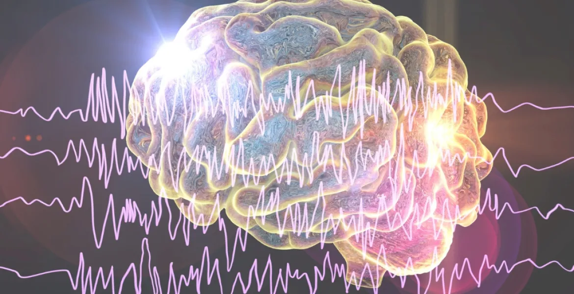 cerebro epilepsia