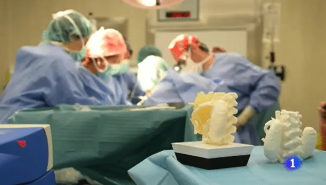 Impresión 3D aplicada a la extirpación de un tumor Impresión 3D aplicada a la extirpación de un tumor