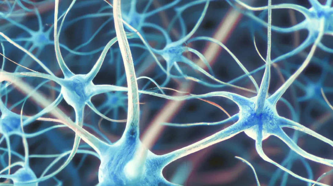 3D recreation of swollen neurons created with the Artificial Intelligence tool DALL-E Imagen en 3D de neuronas inflamadas creada con IA