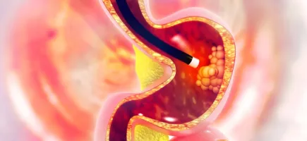 Master's Degree in Paediatric Gastroenterology, Hepatology and Nutrition Master's Degree in Paediatric Gastroenterology, Hepatology and Nutrition