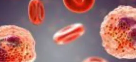 Master's Degree in Clinical Immunology and Primary Immunodeficiencies Master's Degree in Clinical Immunology and Primary Immunodeficiencies