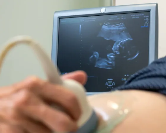 Ecografía embarazo
