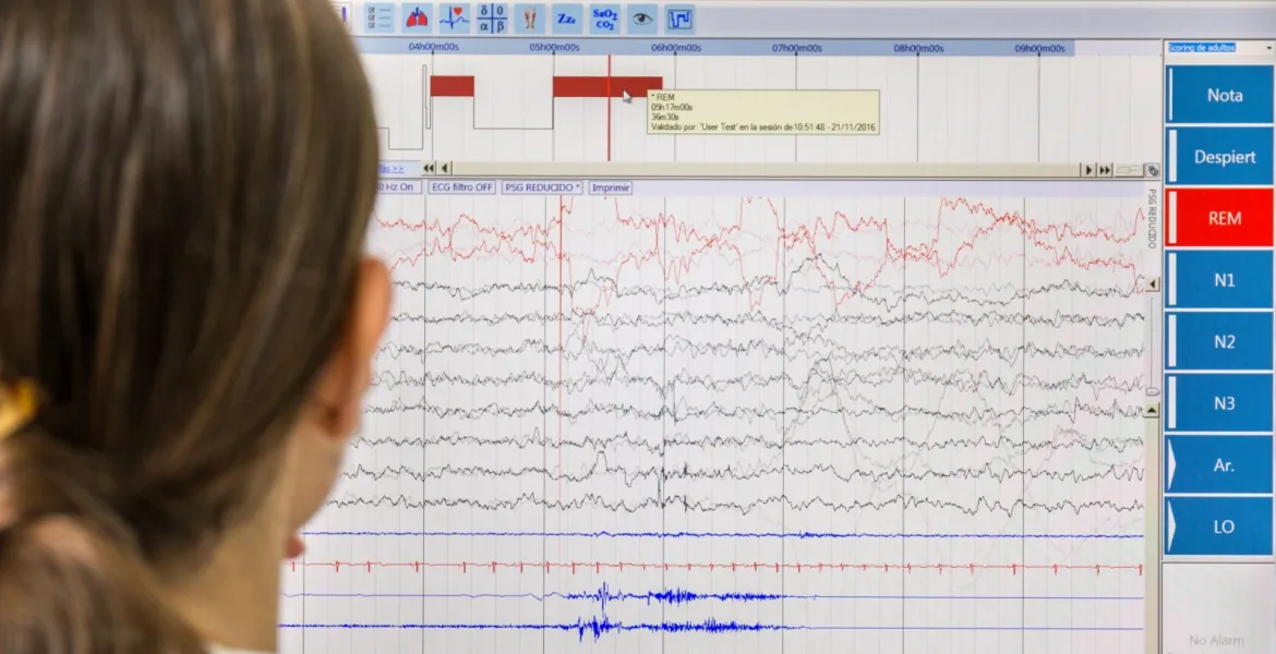 Prueba diagnóstica en la Unidad de Trastornos del Sueño en niños del Hospital Sant Joan de Déu Prueba diagnóstica en la Unidad de Trastornos del Sueño en niños del Hospital Sant Joan de Déu
